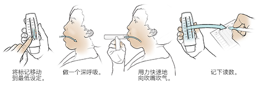 使用肺活量测量仪的五个步骤。