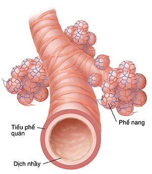 Hình cận cảnh tiểu phế quản và phế nang.