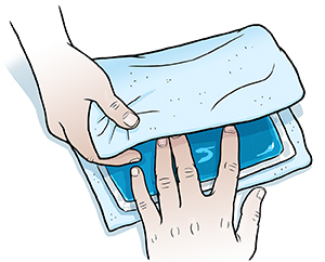 Closeup of man's hands wrapping ice pack in thin towel.