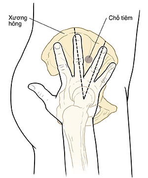 Phác thảo hình chiếu cạnh phần dưới cơ thể, hông, và bắp đùi với vùng chậu và xương chân. Bàn tay với các ngón tay duỗi ra là lòng bàn tay úp xuống nơi xương chân tiếp xúc với hông. Đường chấm quanh đường tròn giữa hai ngón tay giữa.